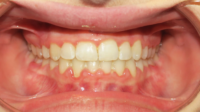 Kiara-Feilberg-After Kiara-Feilberg-After