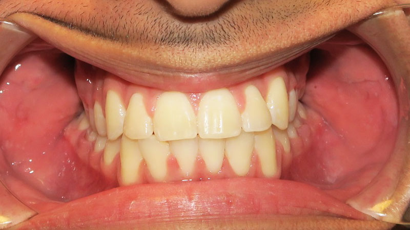 Michael-Callente-After Michael-Callente-After