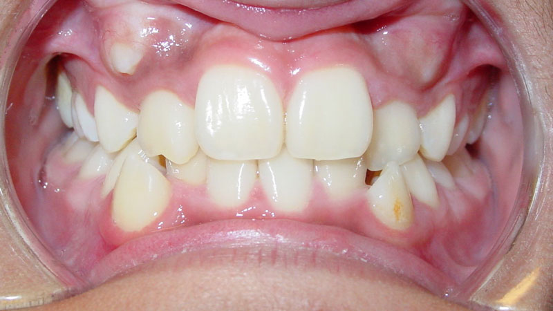 Tony-Alvarado-Before Tony-Alvarado-Before