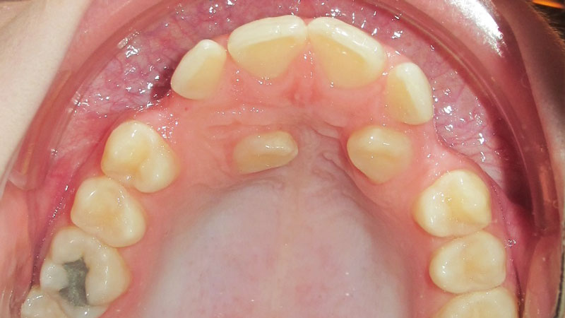 Tori-Graham-Before Tori-Graham-Before