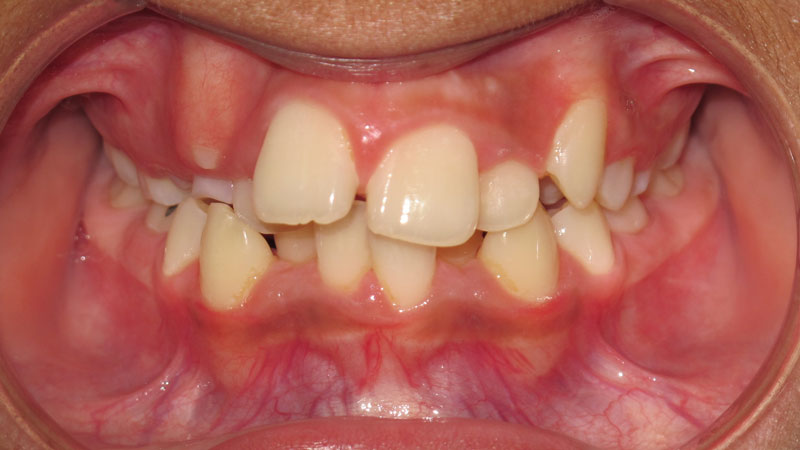 Victor-Bravo-Before Victor-Bravo-Before