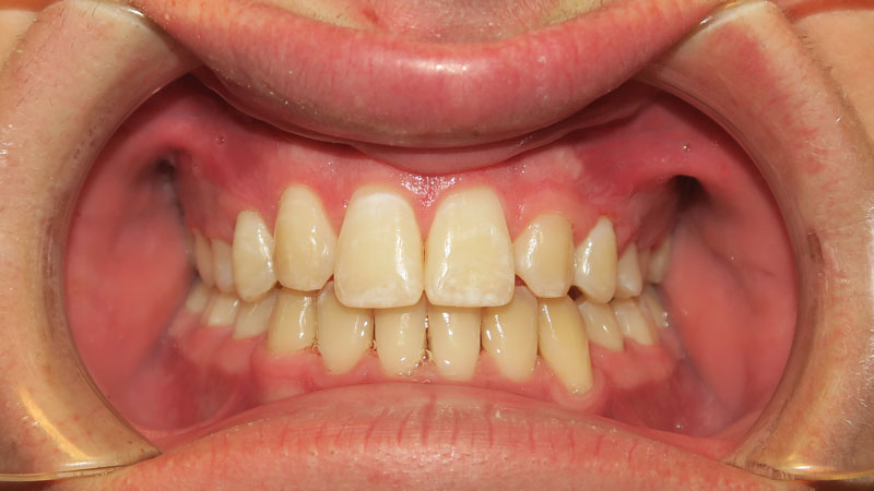 William-Farris-After William-Farris-After