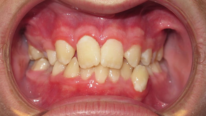 William-Farris-Before William-Farris-Before