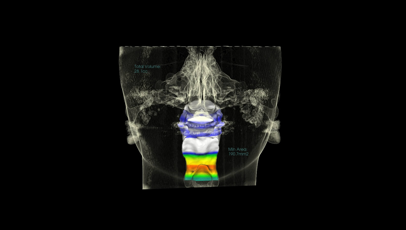 Marlo Miller – Before & After Airway Photos Marlo Miller - Before & After Airway Photos